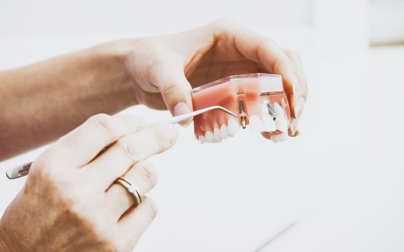 does-medicare-cover-dental-implants-dental-services