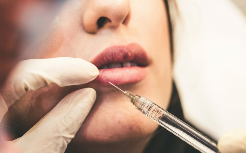 how-long-does-lip-filler-last-the-reason 